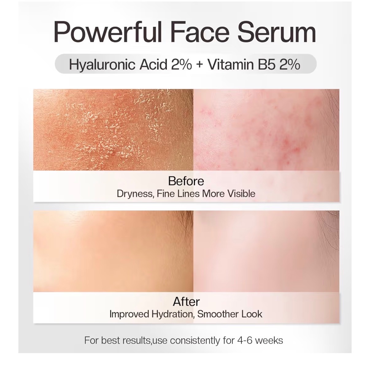 2% HYALURONIC ACID SERUM gallery
