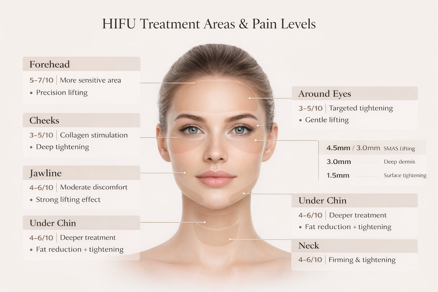 HIFU face areas diagram showing pain levels, treatment depth (4.5mm, 3.0mm, 1.5mm) and results including lifting, tightening and fat reduction