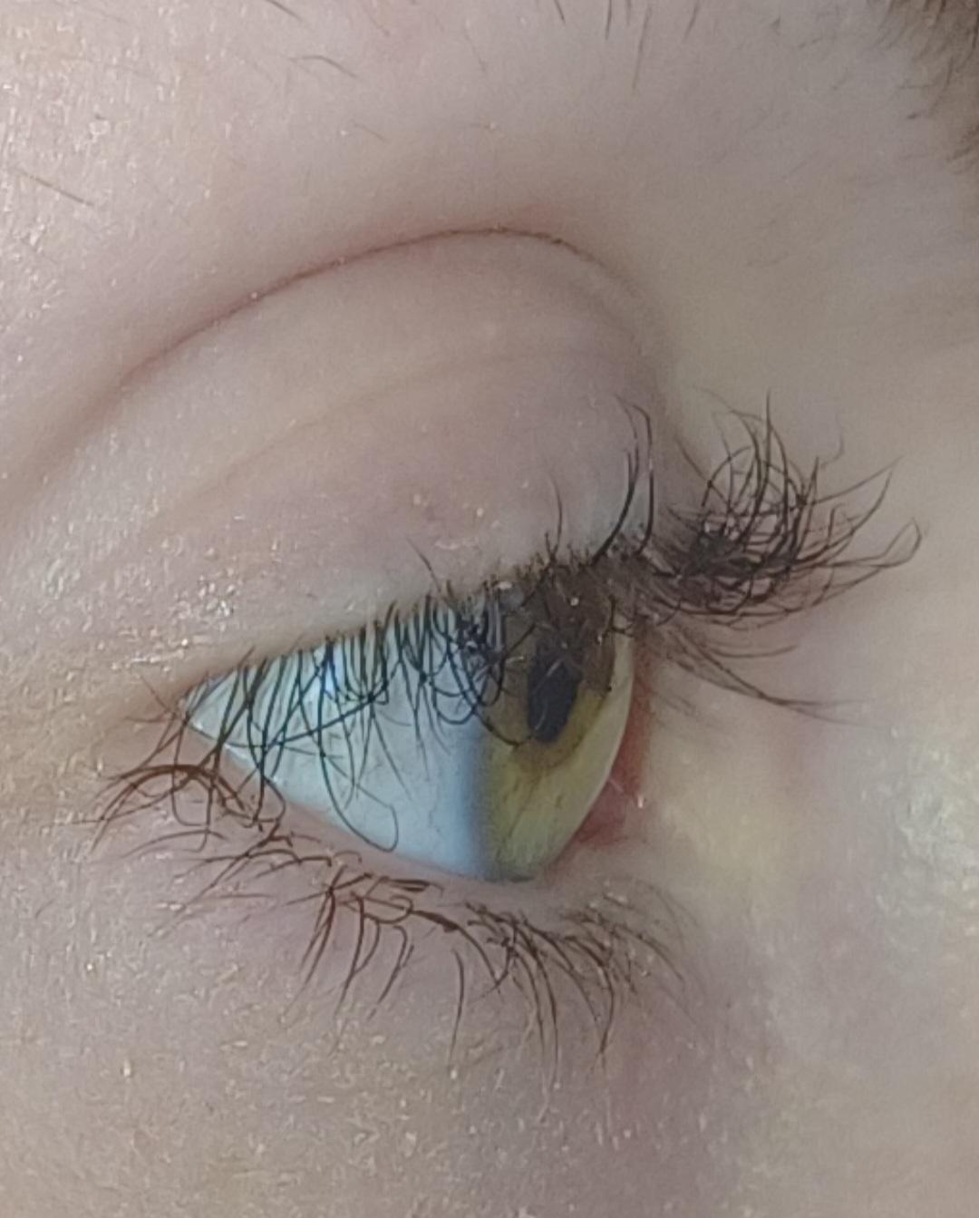 Lash damage from thioglycolate lash lift - overprocessed lashes example 1