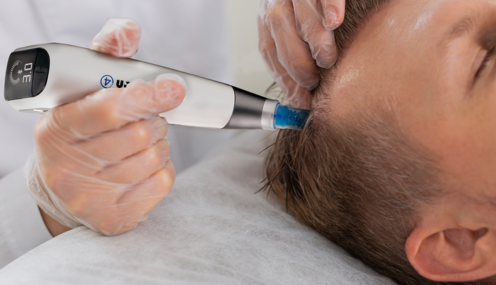 Medical microneedling device on scalp