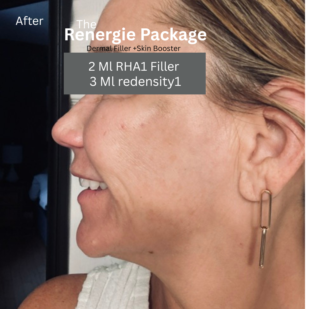 After Renergie Package - smooth rejuvenated skin