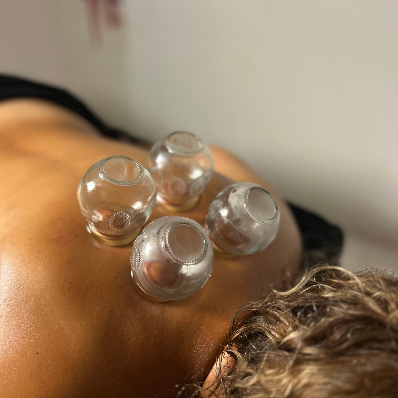 Cupping Therapy