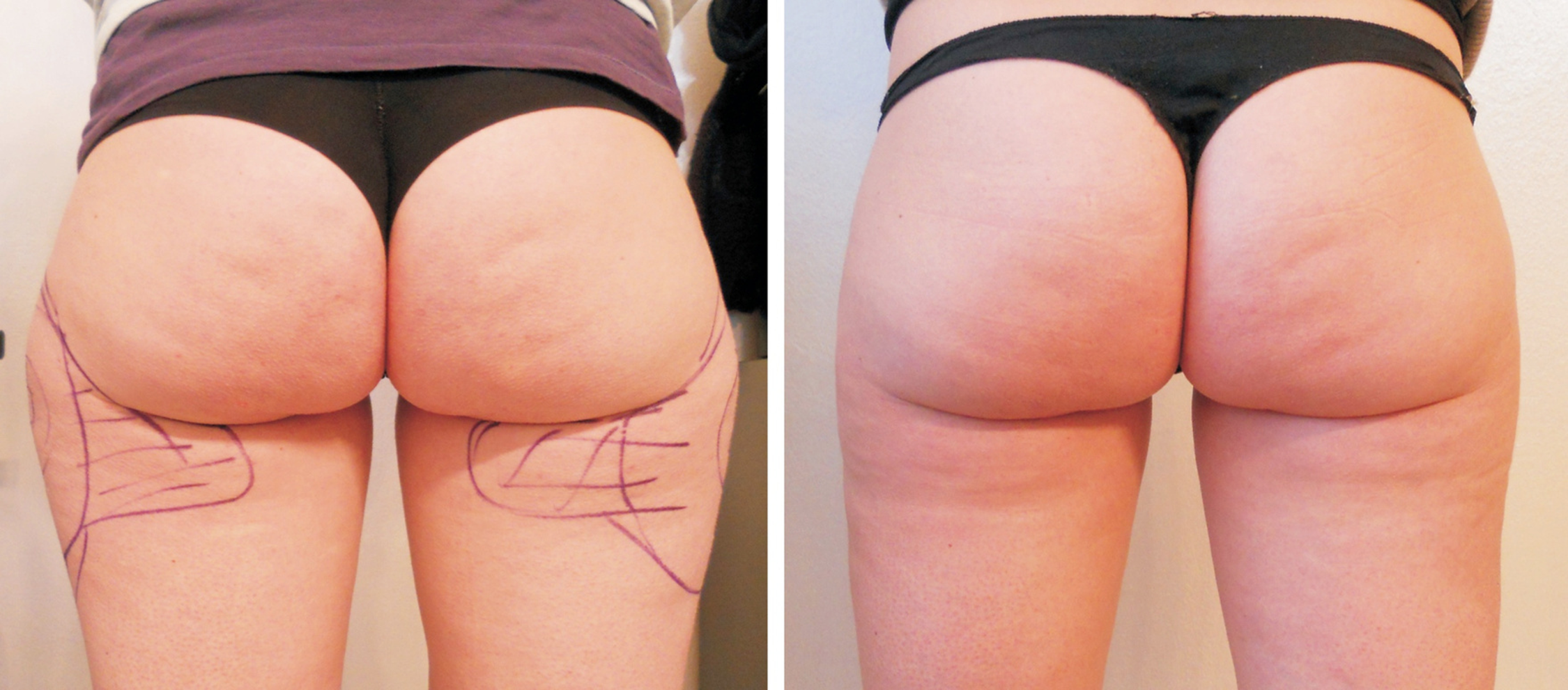 Culotte de Cheval