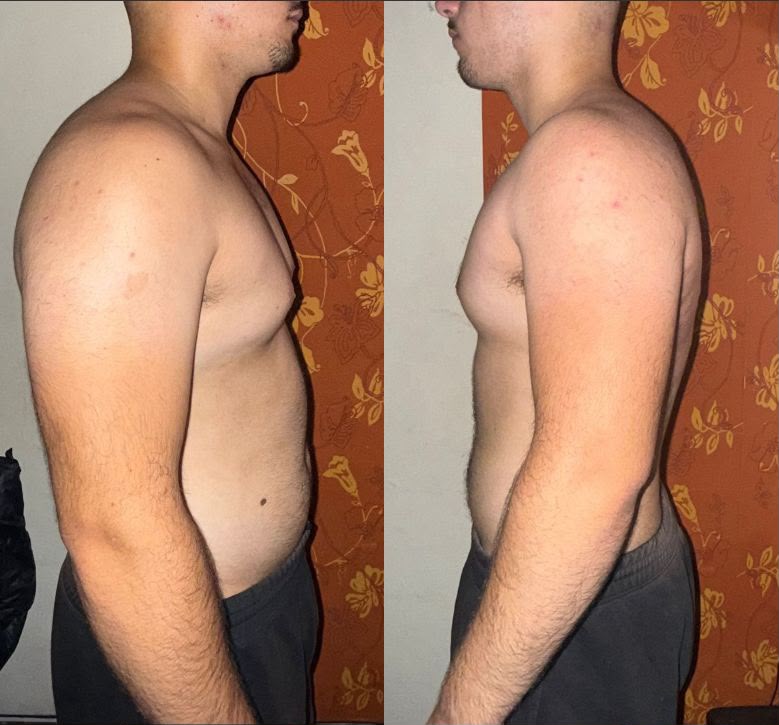 Antes e Depois