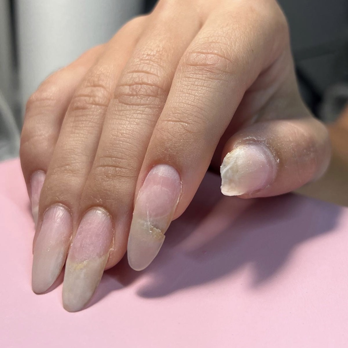 Nail transformation before - Nail services Tampa FL