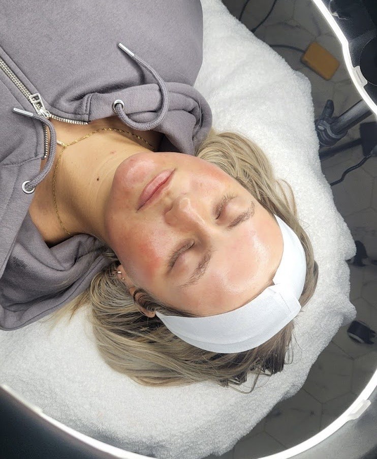 Anti-Aging Treatments