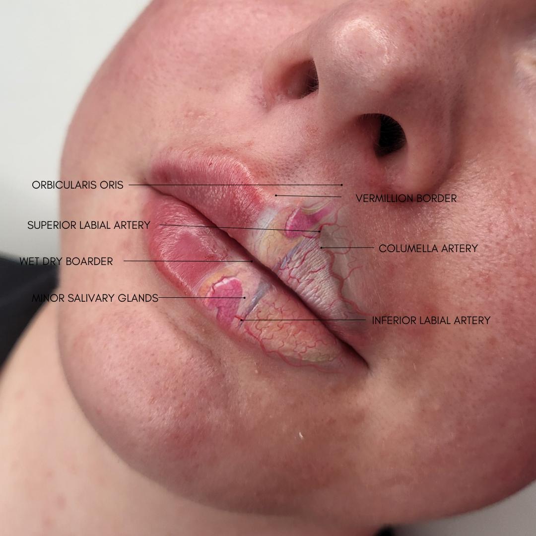 Lip Augmentation