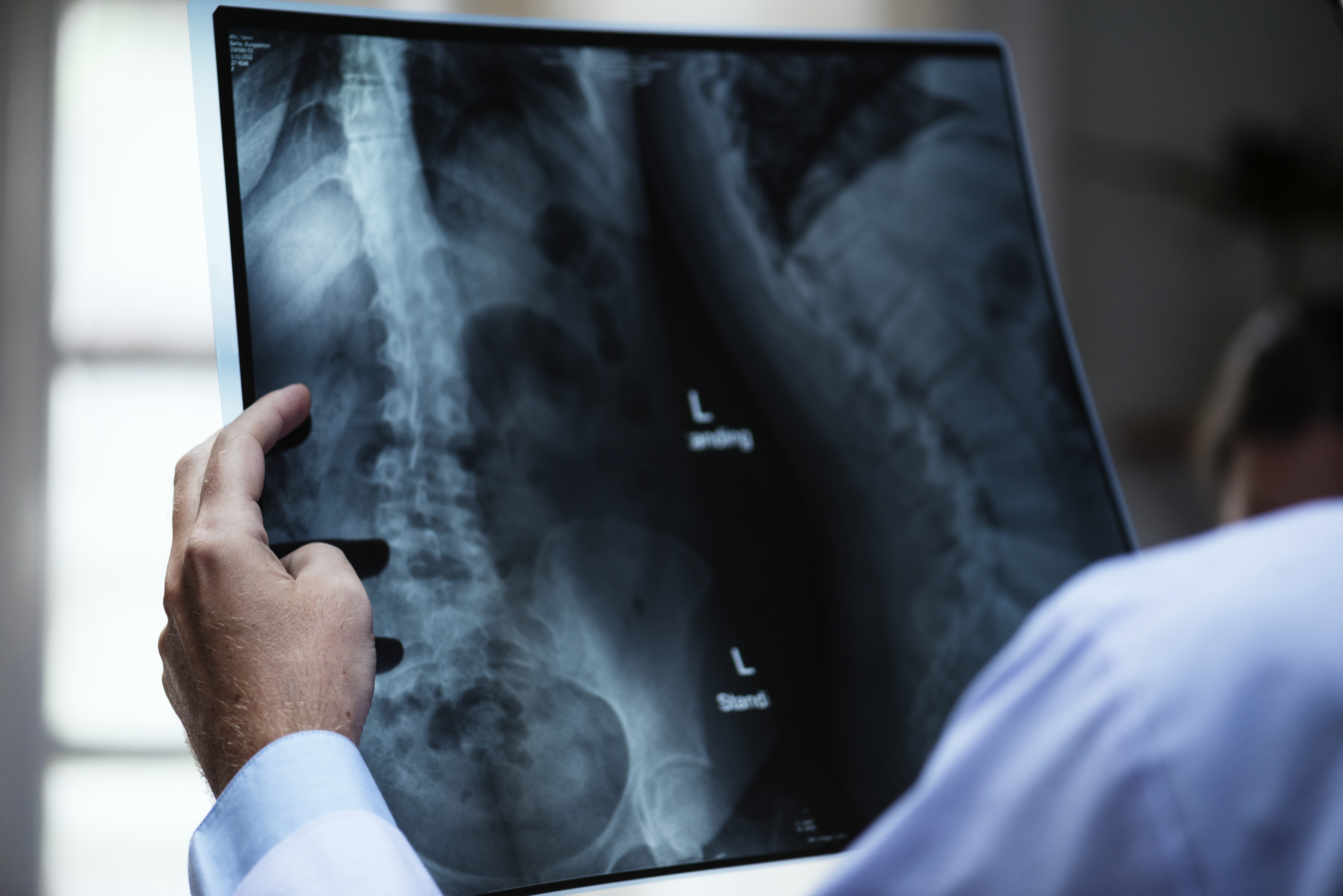 Medical professional with X-ray