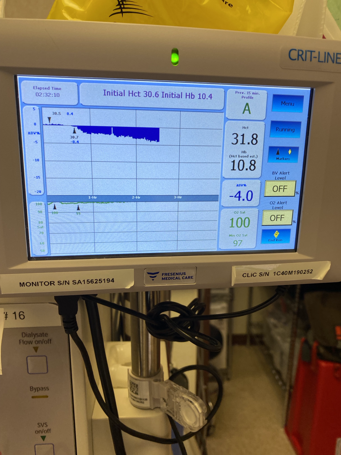 Dialysis treatment monitoring