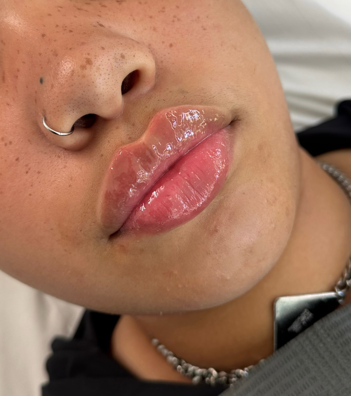 Non-Surgical Enhancements