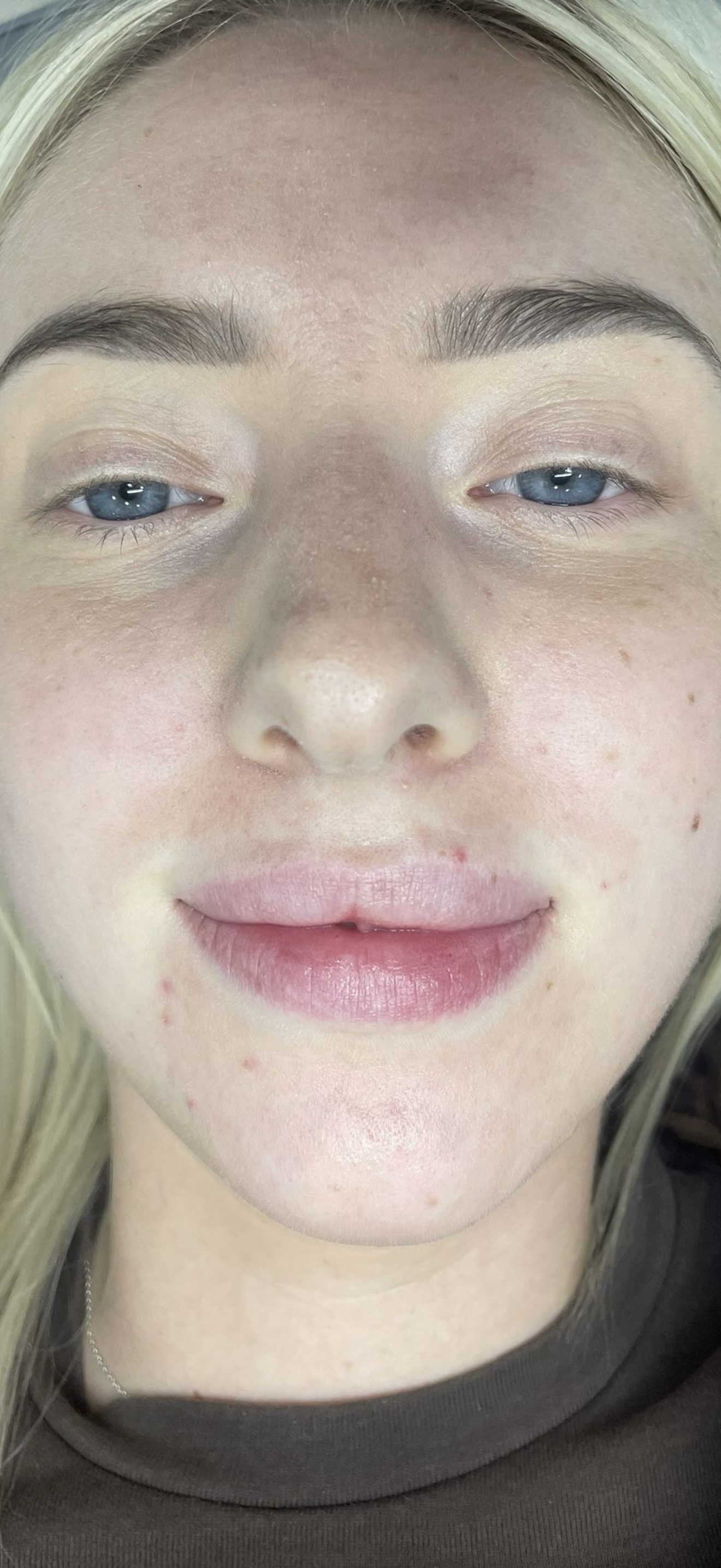 The Perfect Pout - Before