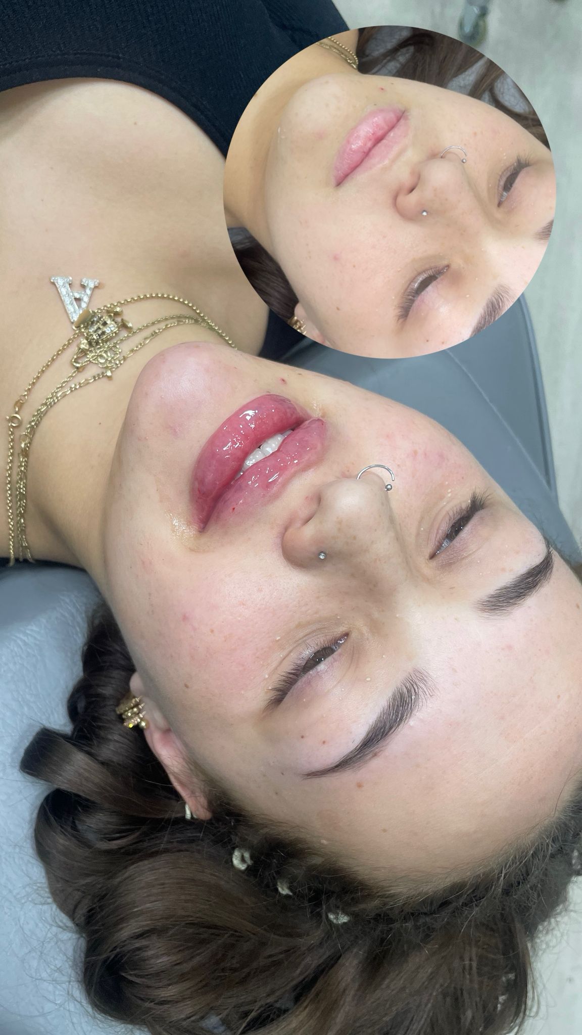 Treatment results