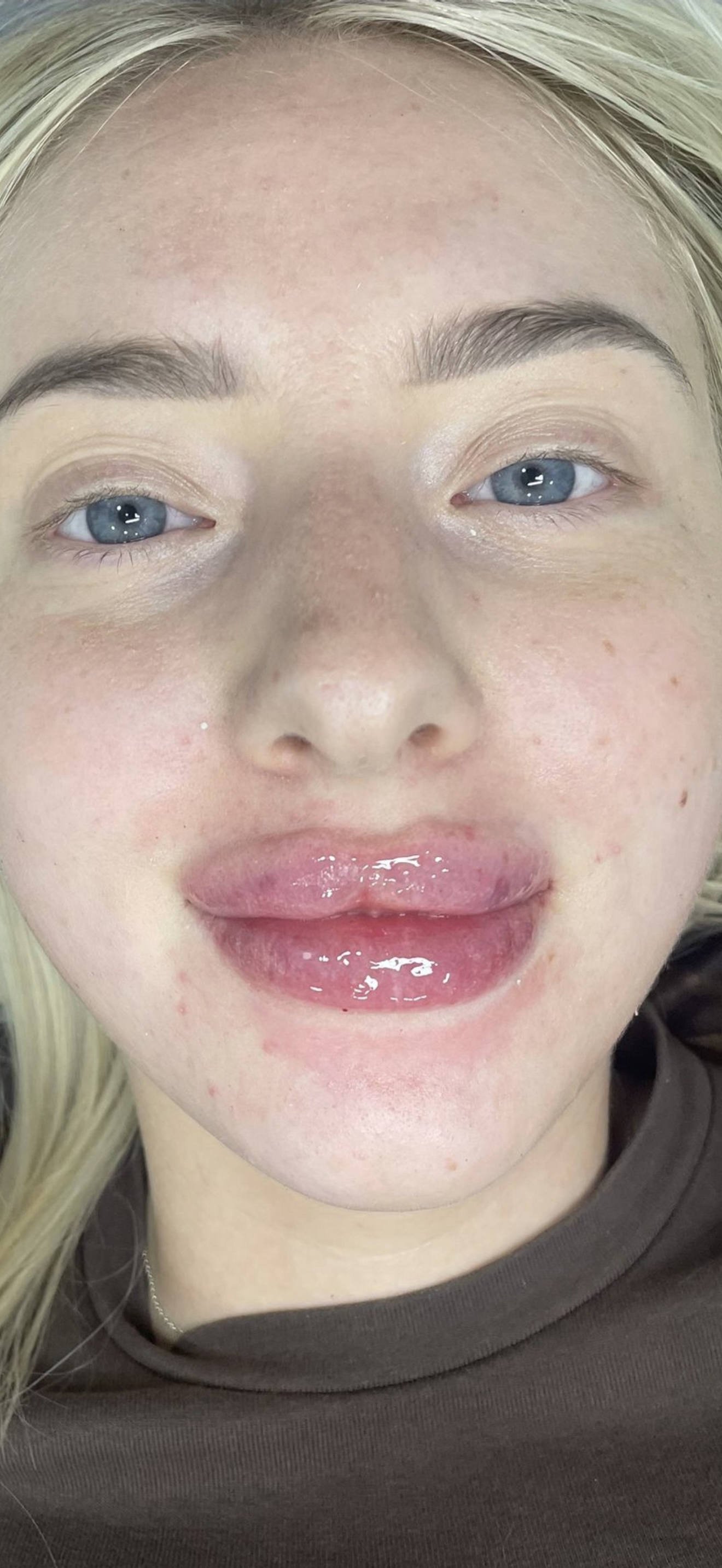 The Perfect Pout - After