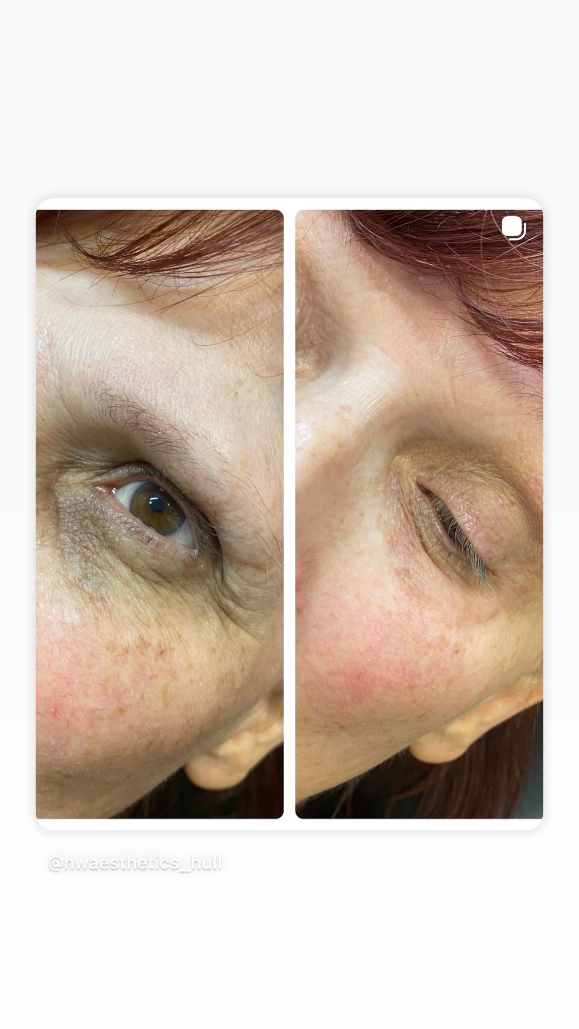 Treatment results