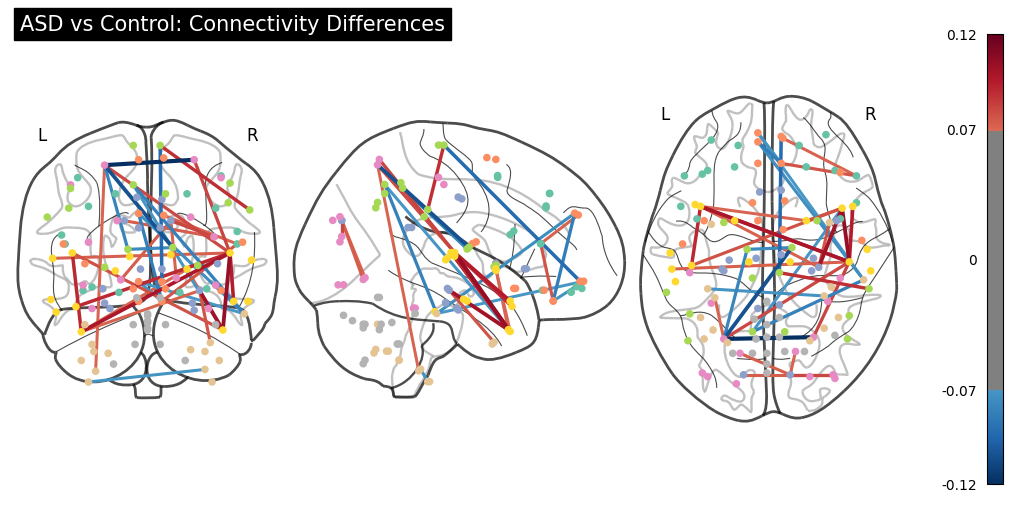 ASD Classification from fMRI Connectomes
