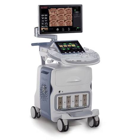 GE Voluson Ultrasound