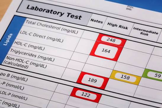 Lab analysis