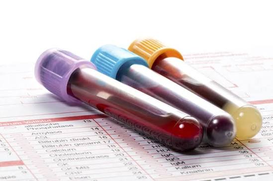 Lab test results