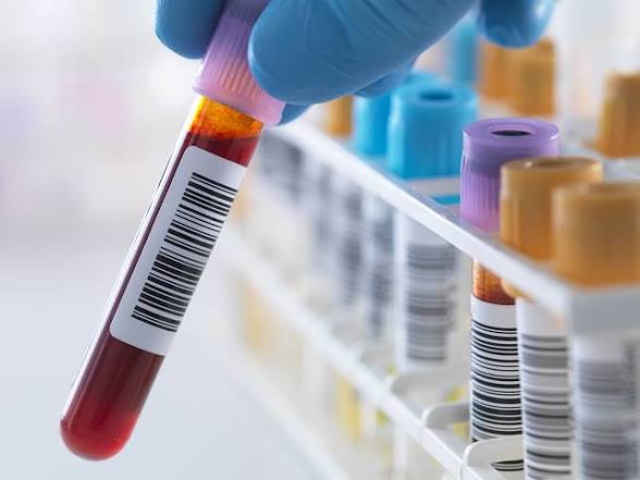 Blood test tubes