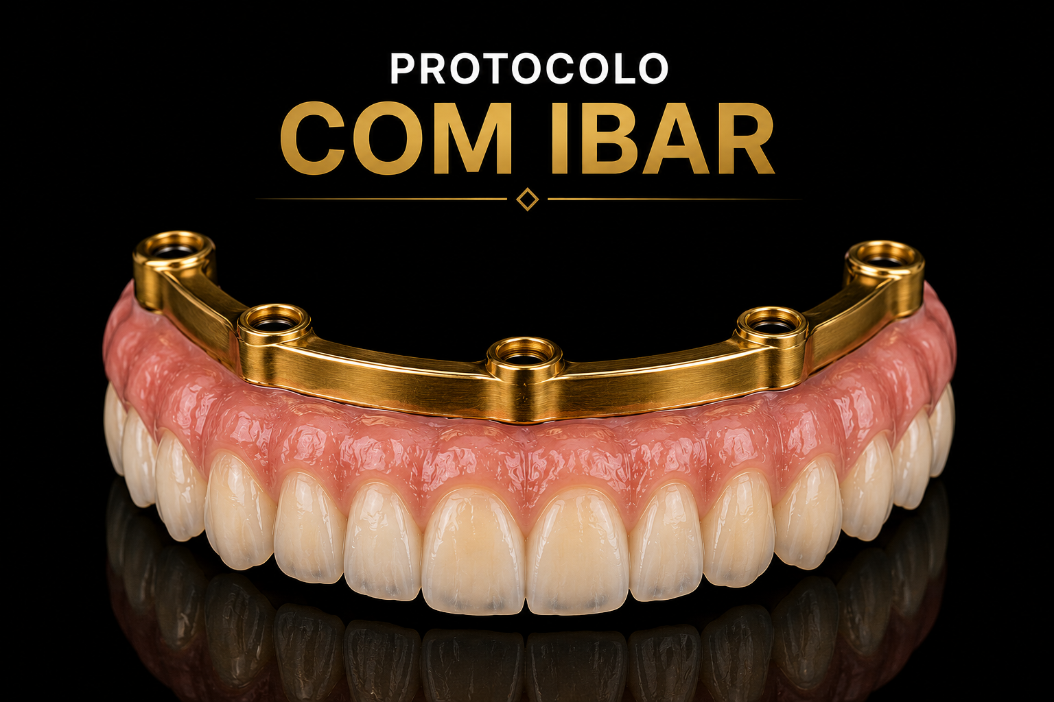 Protocolo com IBAR — barra dourada sobre implantes