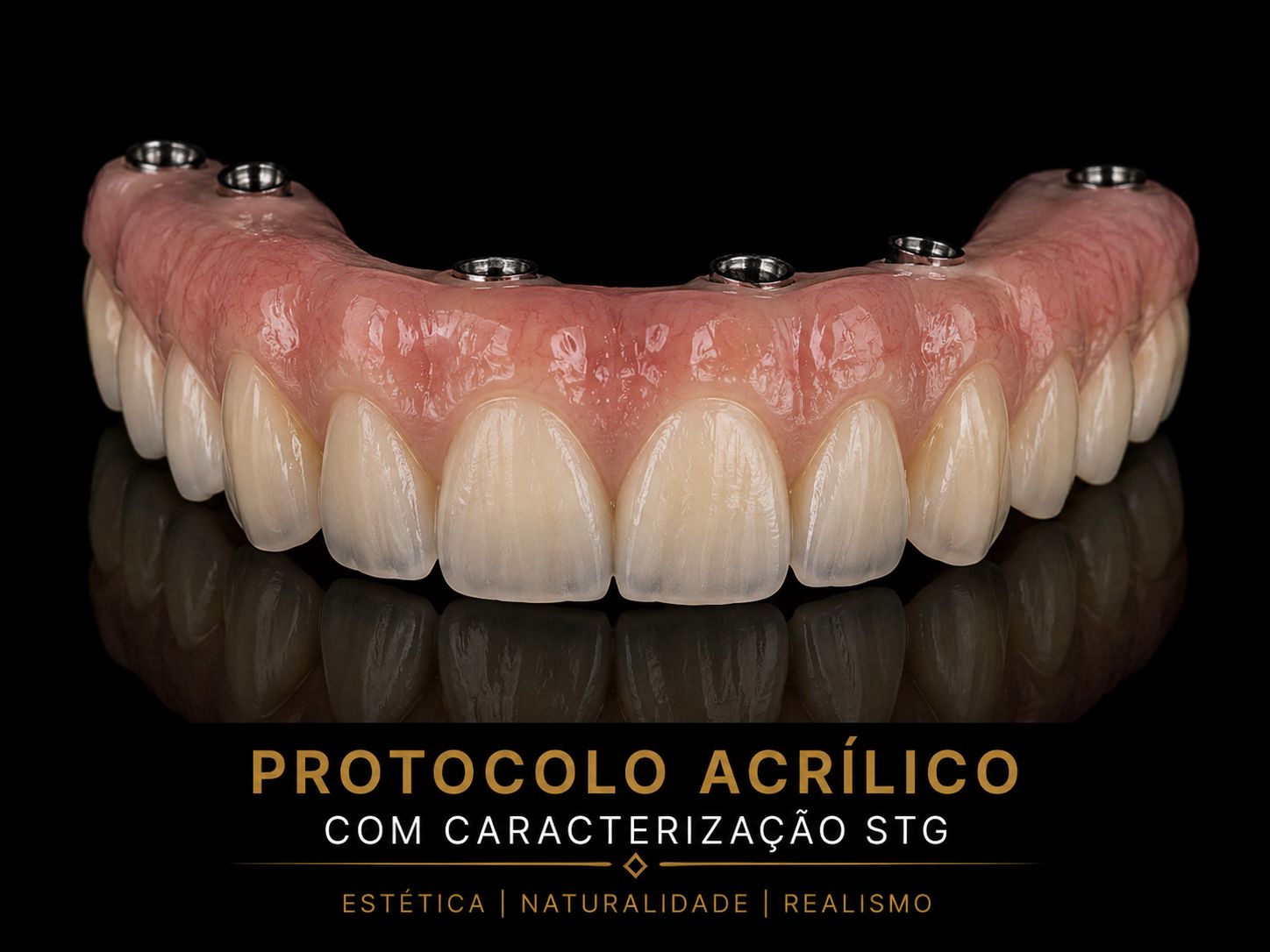 Protocolo acrílico com caracterização STG