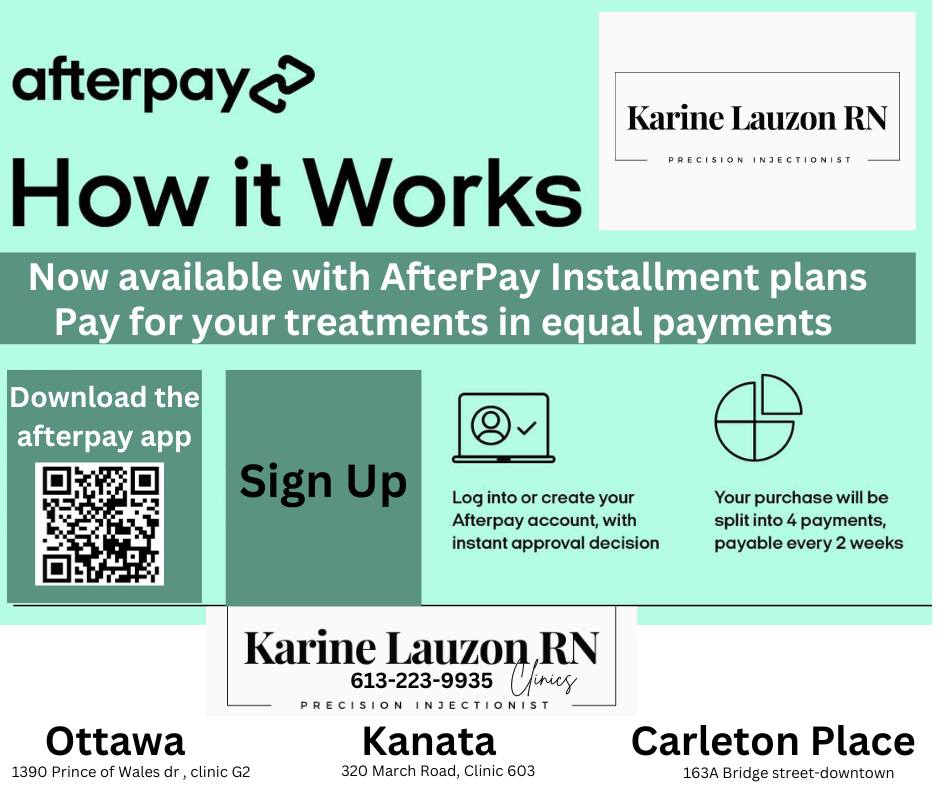 Afterpay - How it Works