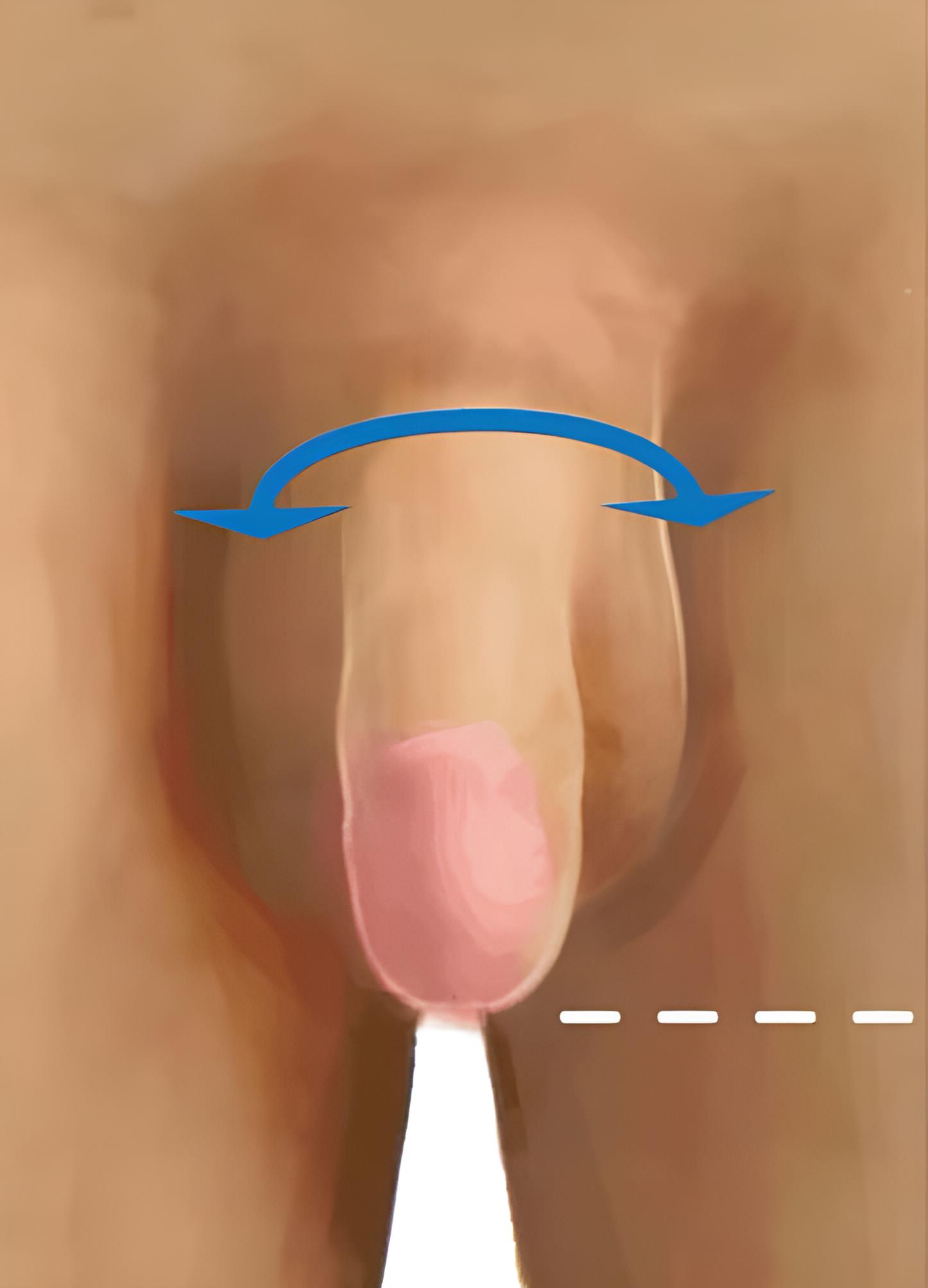Avant