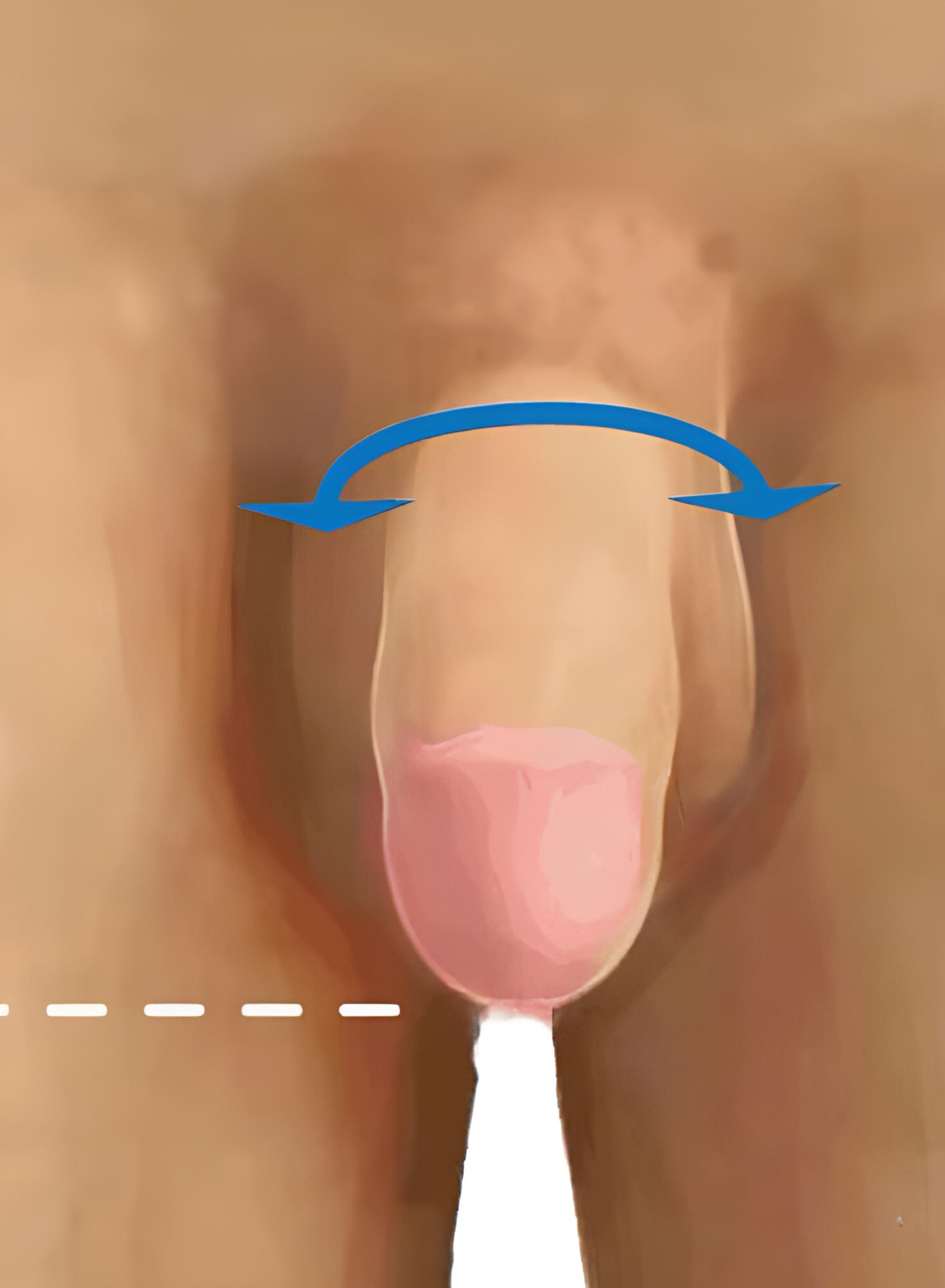 Après