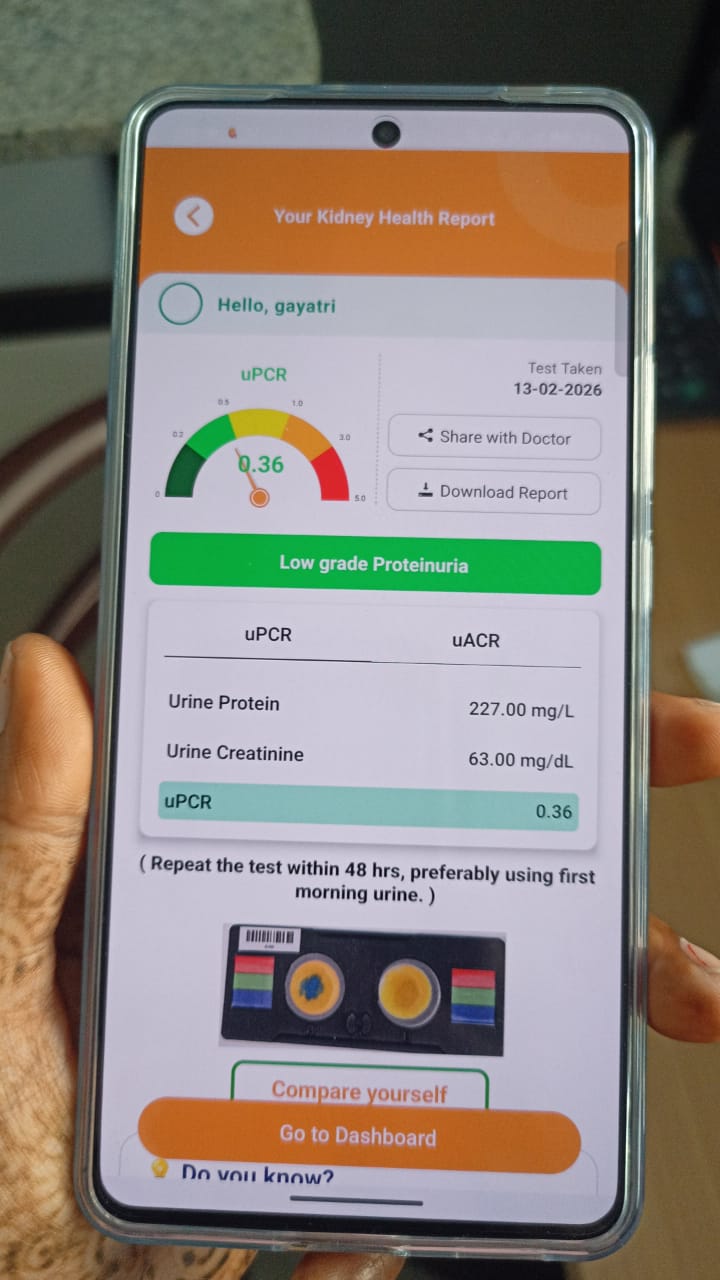KidneyCheQ App - Kidney Health Report showing uPCR results