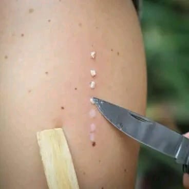 Kambo dots being prepared for application