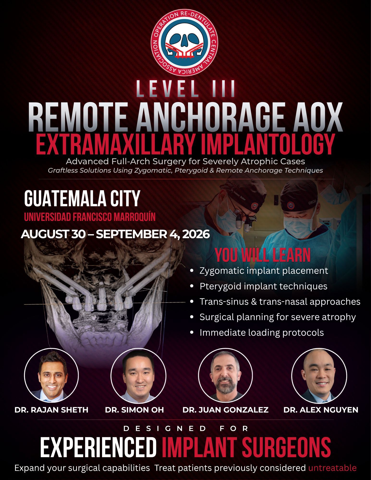 Level III — Remote Anchorage AOX: Extramaxillary Implantology