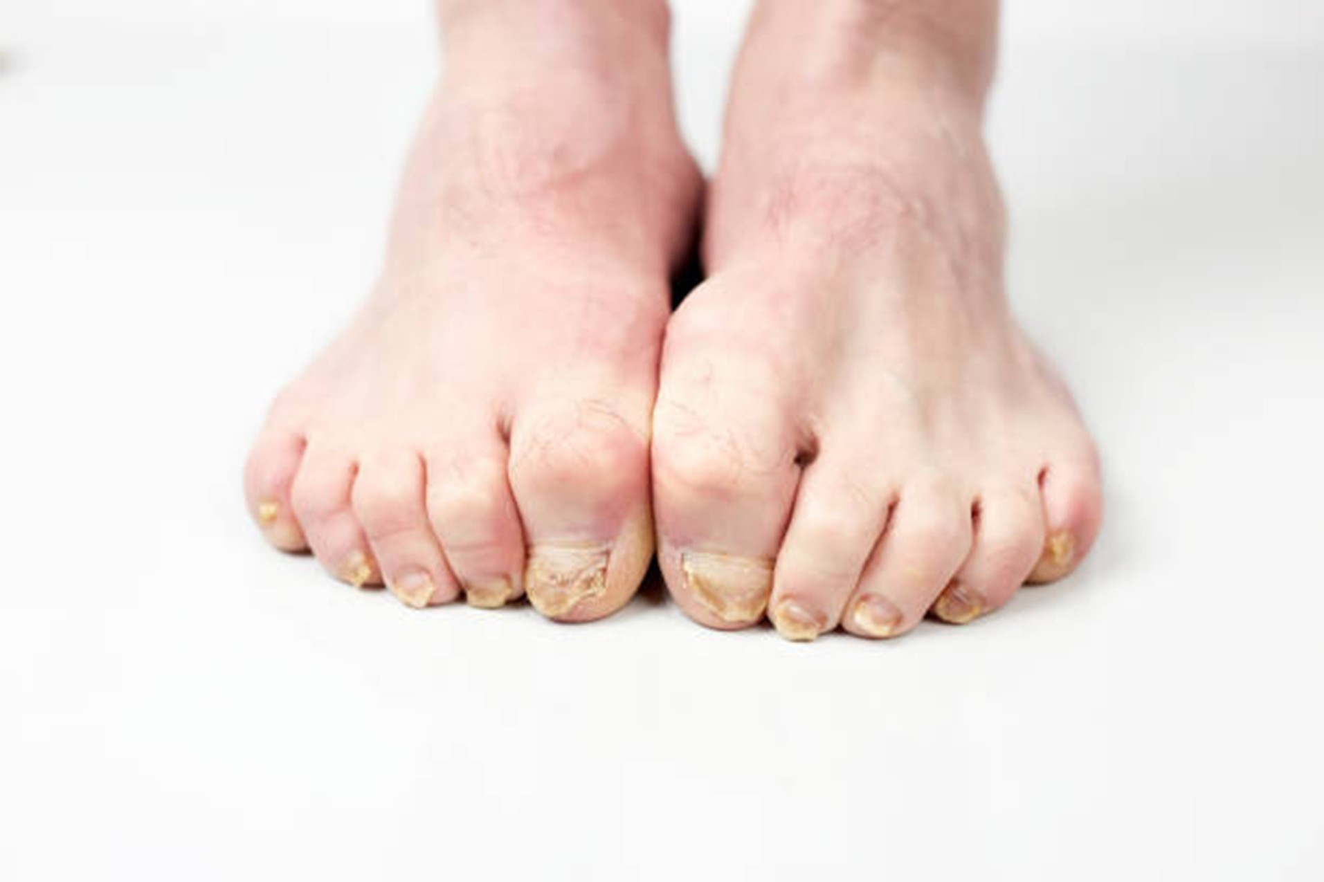 Comprehensive Foot Assessment