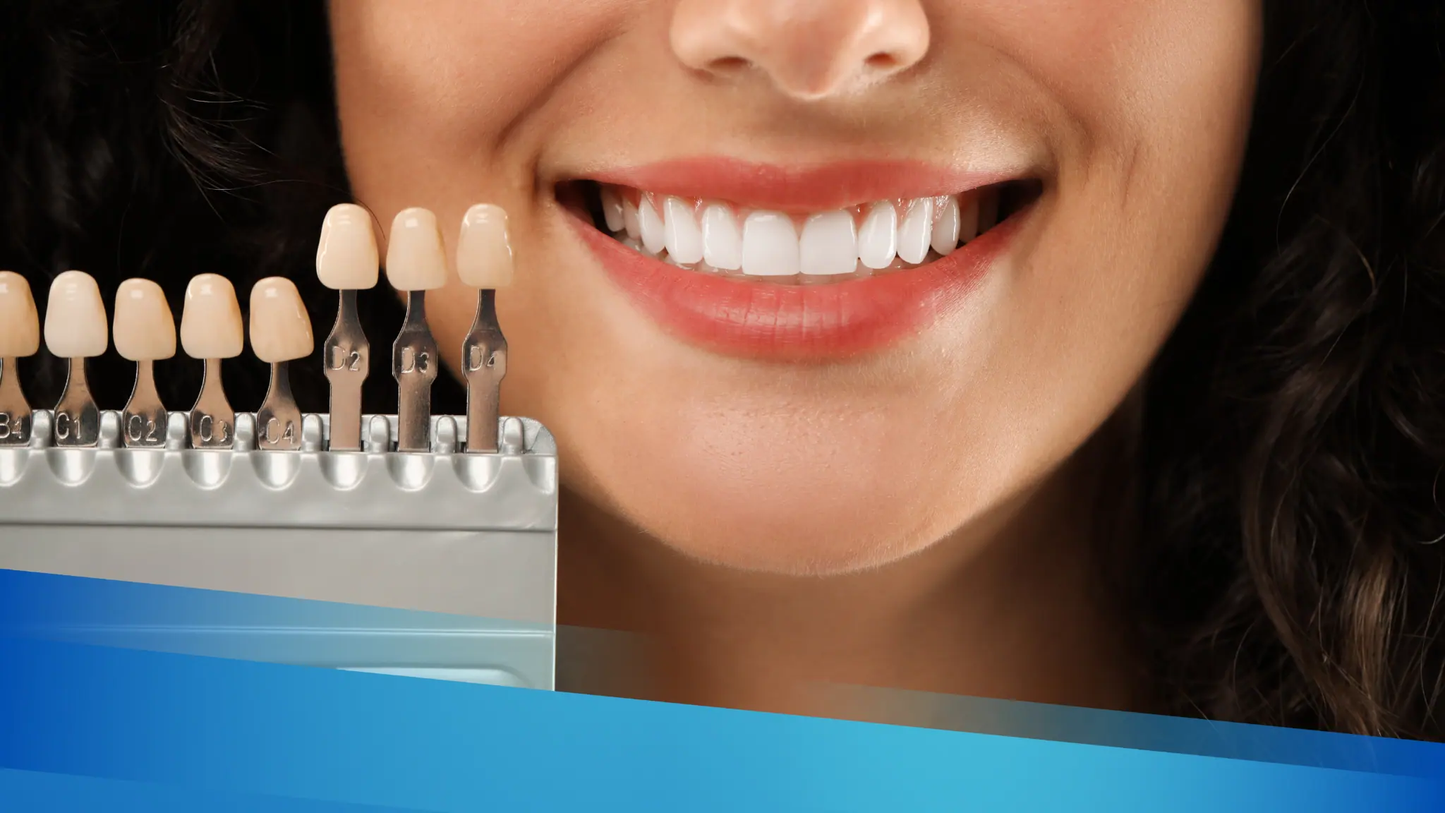 Blanqueamiento Dental en El Salvador: Precios y Métodos 2025