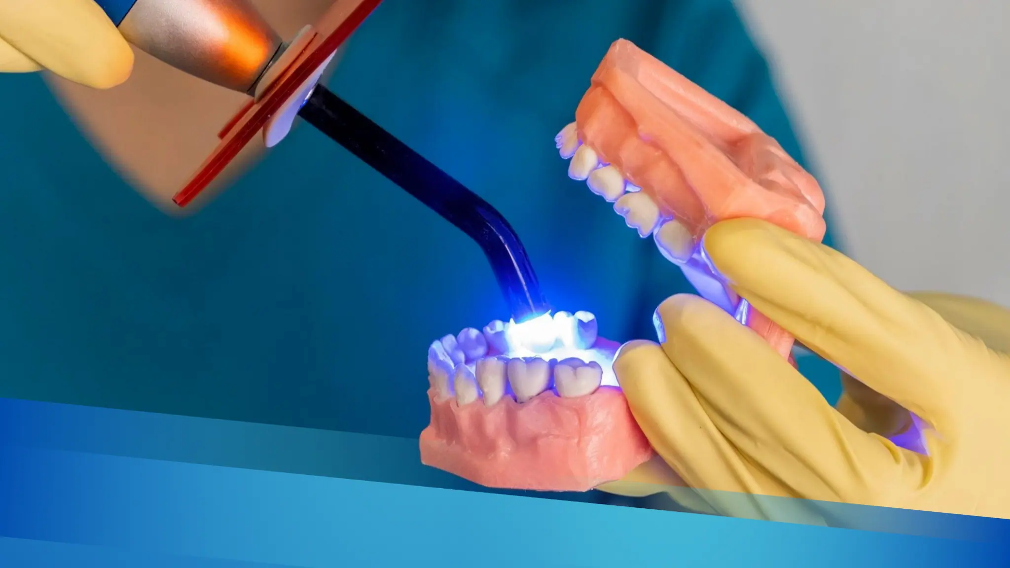 Dientes Amarillos: Causas y Cómo Blanquearlos Efectivamente