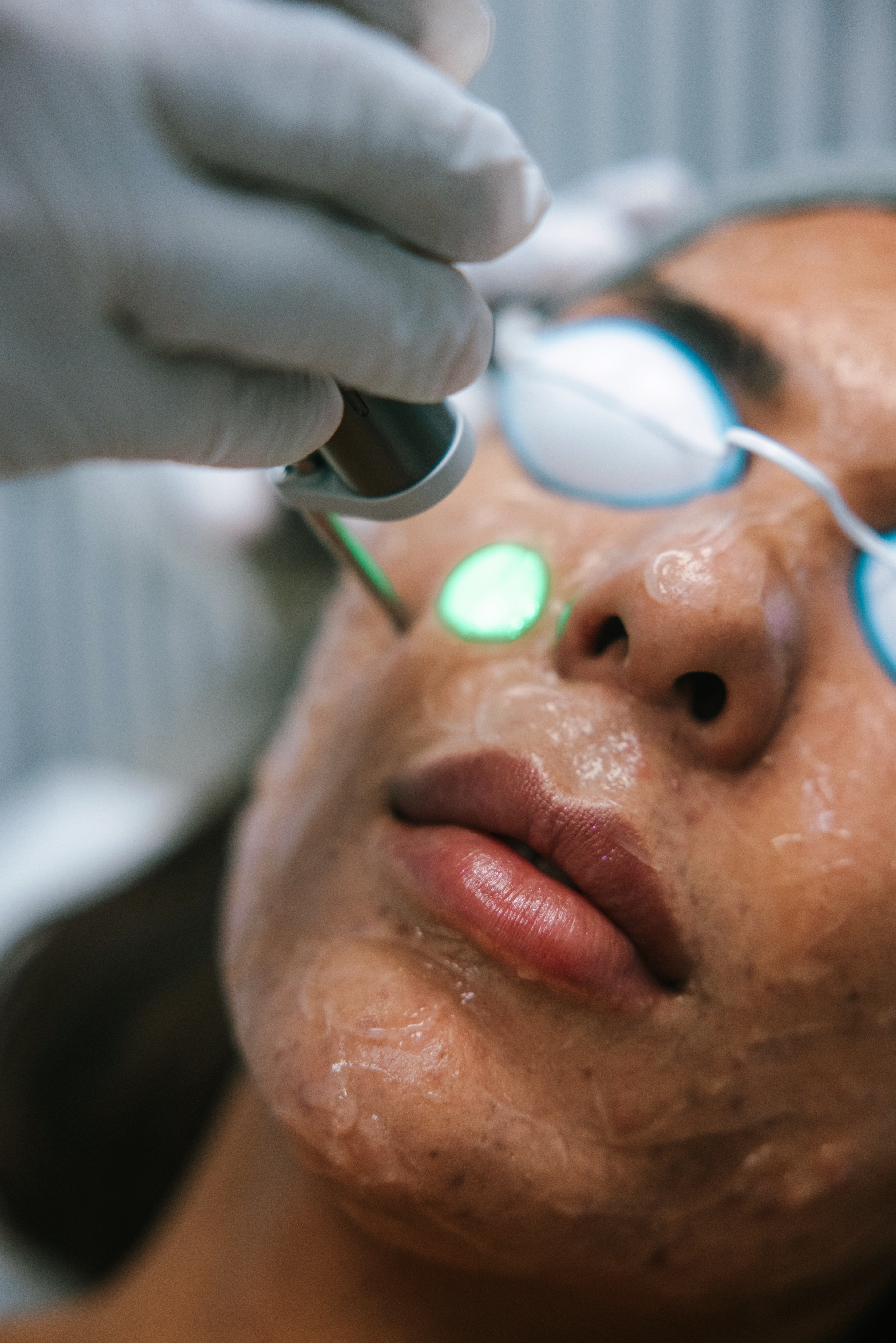 Facial treatment